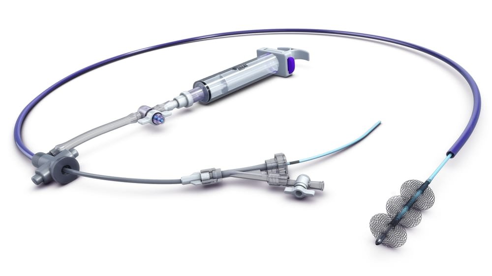 Sistema FlowTriever de Inari Medical: catéter de trombectomía con jeringa de aspiración y punta de nitinol expandible