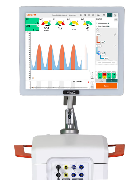 Plataforma MiraQ Cardiac de Medistim: carro móvil con monitor mostrando flujometría TTFM e imagen intraoperatoria